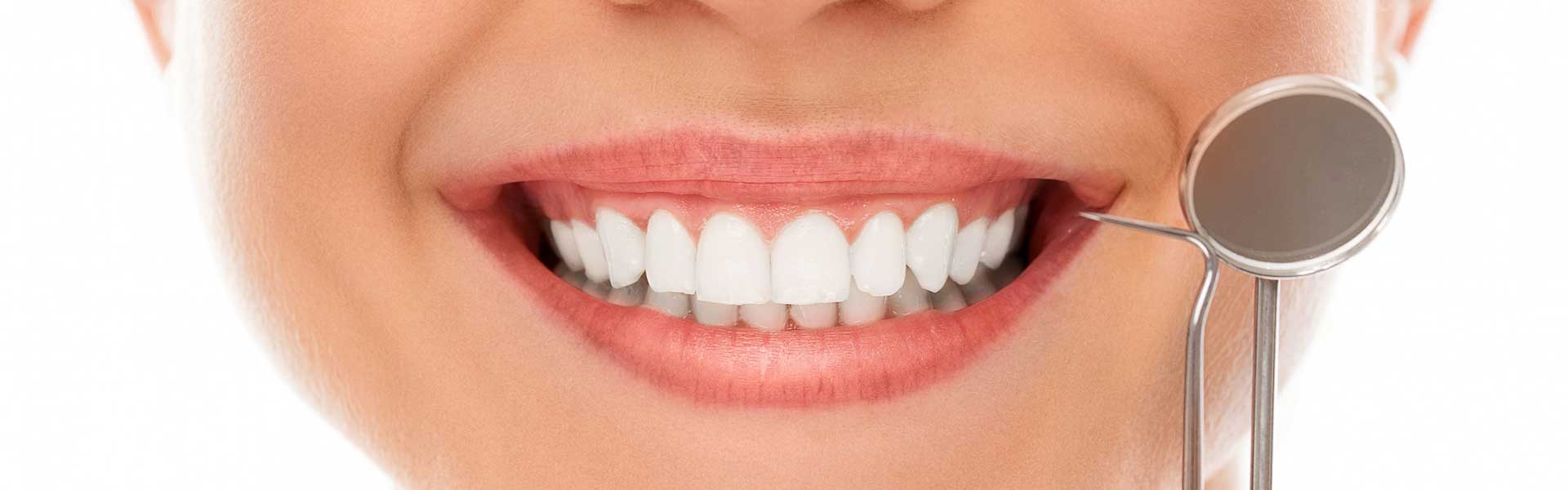 Sonrisa estética - Clínica dental Brasilocho - Clínica dental Cádiz - Odontología - Dentistas en Cádiz