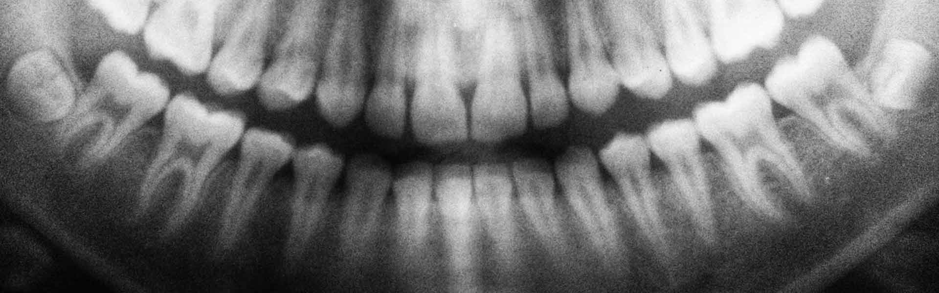 TAC - Diagnóstico imagen - Clínica dental Brasilocho - Clínica dental Cádiz - Odontología - Dentistas en Cádiz